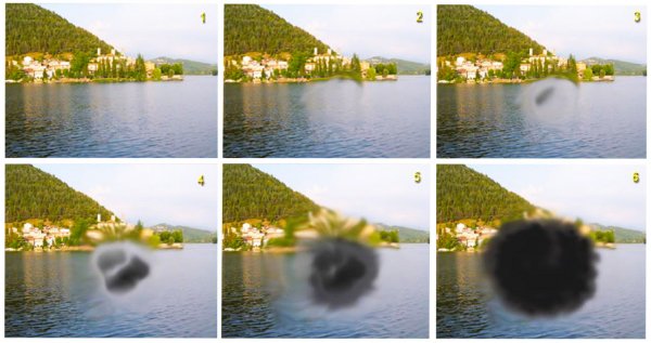 Cosa è la maculopatia e si può curare? Cosa è la maculopatia e si può curare?