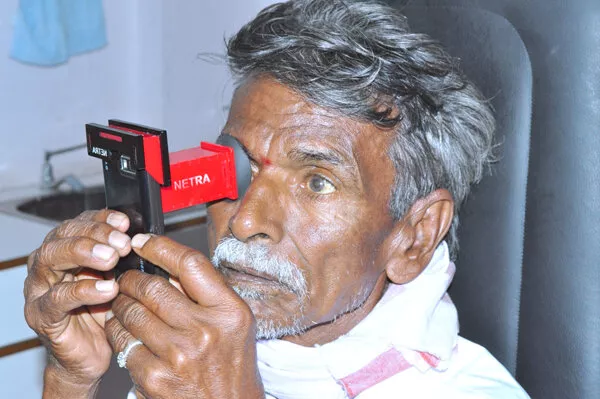 Test della vista con telefono cellulare. Sistema  NETRA