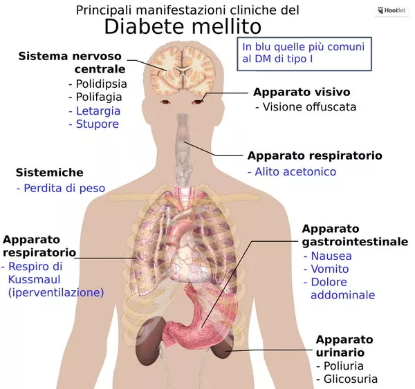 DISTURBI VISIVI NEI SOGGETTI DIABETICI