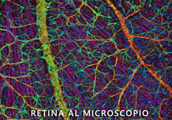 Retinopatia ipertensiva: quanto incide l’ipertensione arteriosa sull’incidenza della malattia? Retinopatia ipertensiva: quanto incide l’ipertensione arteriosa sull’incidenza della malattia?