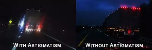 Cosa è l’astigmatismo–Cause–Diagnosi–Cura.