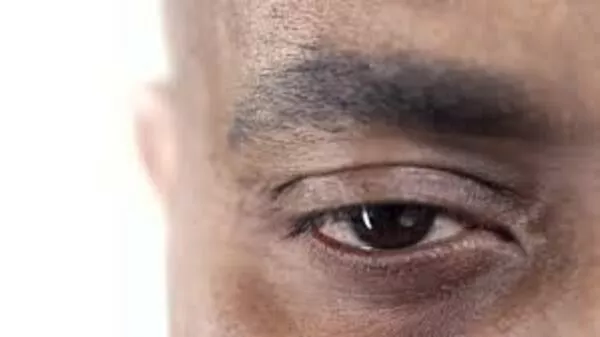 OCCHI STANCHI – CAUSE, SINTOMI, CURE.