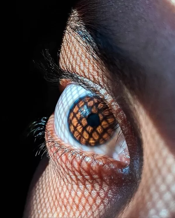 Malattie degli occhi quando bisogna preoccuparsi Malattie degli occhi quando bisogna preoccuparsi