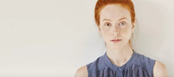 Occhi di colore diverso: parliamone