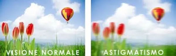 ASTIGMATISMO – CHE SIGNIFICA?